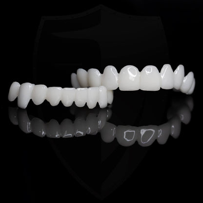 Snap-On Cosmetic Veneers