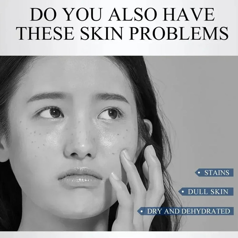 Brightening Anti-Freckle Cream for Spot Removal, Moisturizing and Even Tone