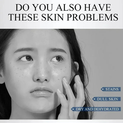 Brightening Anti-Freckle Cream for Spot Removal, Moisturizing and Even Tone