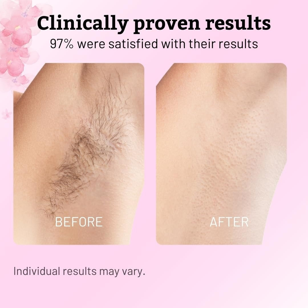Cyperus Rotundus Hair Inhibitor Oil with Deep Hydration & Skin Repair, Reduces Ingrown Hairs & Red Spots