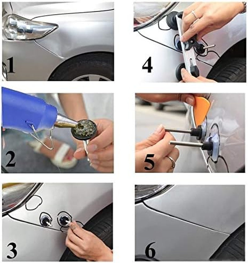 Paintless Car Dent Puller Removal Tool Kit, Auto Body Dent Puller Kit