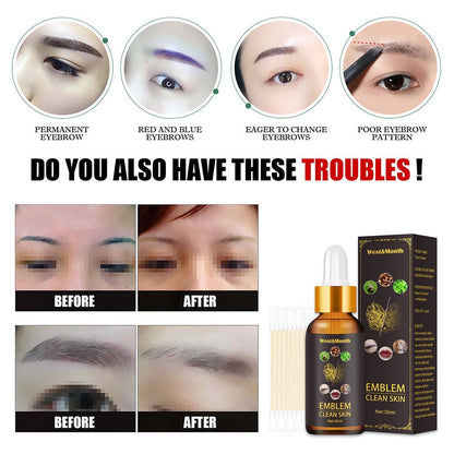 Quick Tattoo Removal Liquid Safe, Painless, and Natural Skin Cleaning