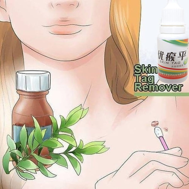Skin Tag Mole Wart Remover