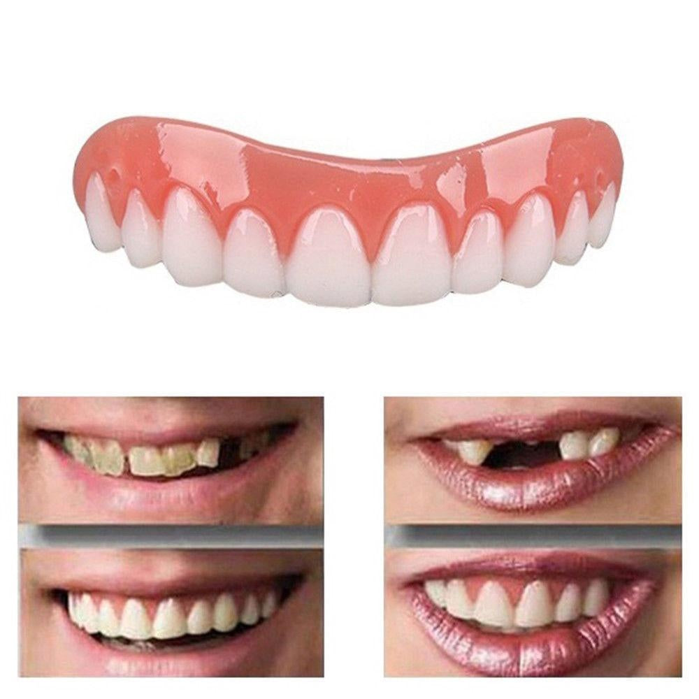 Soft Denture Reline Kit for Natural Smile and Comfort