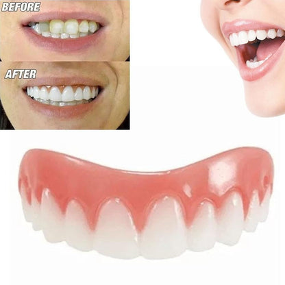 Soft Denture Reline Kit for Natural Smile and Comfort