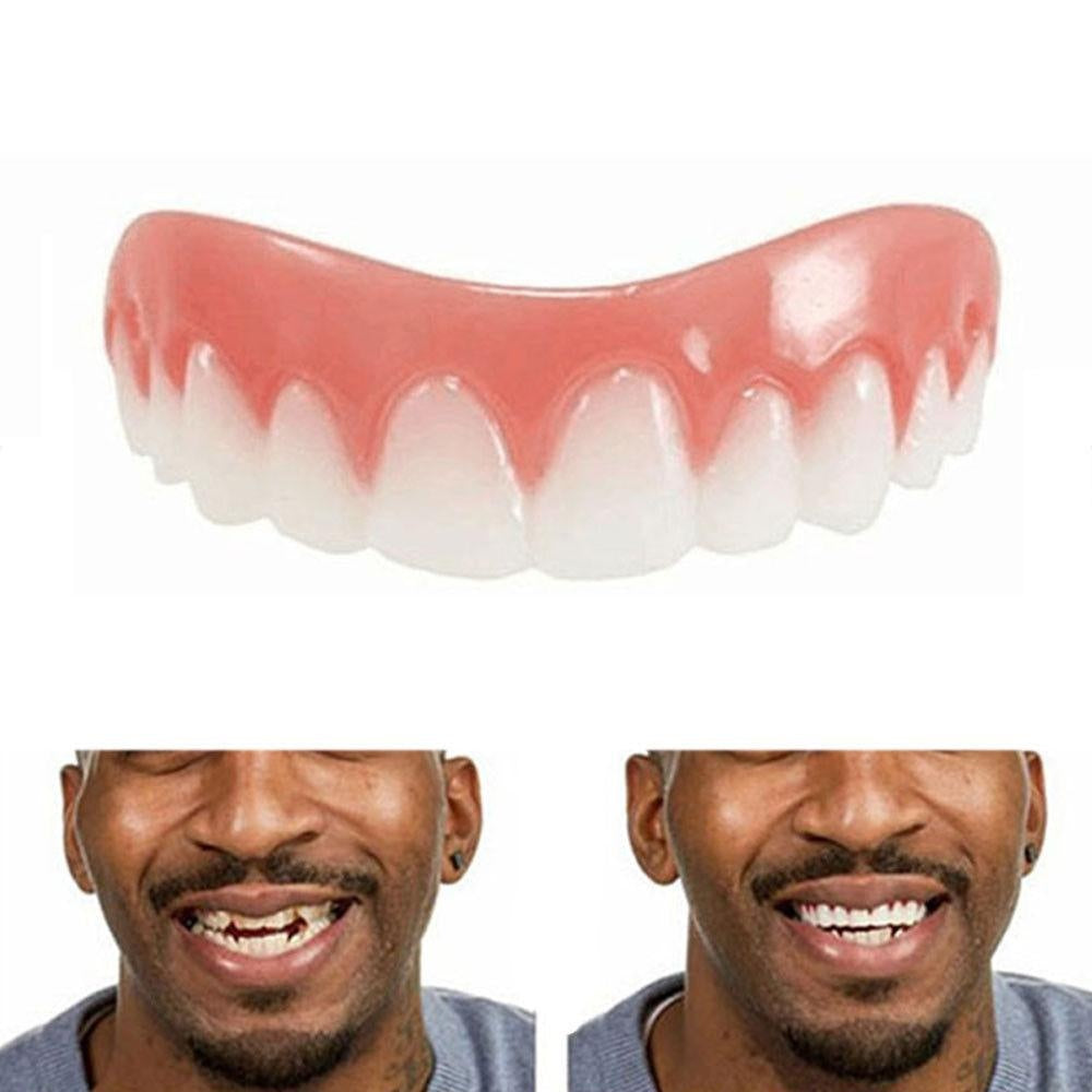 Soft Denture Reline Kit for Natural Smile and Comfort