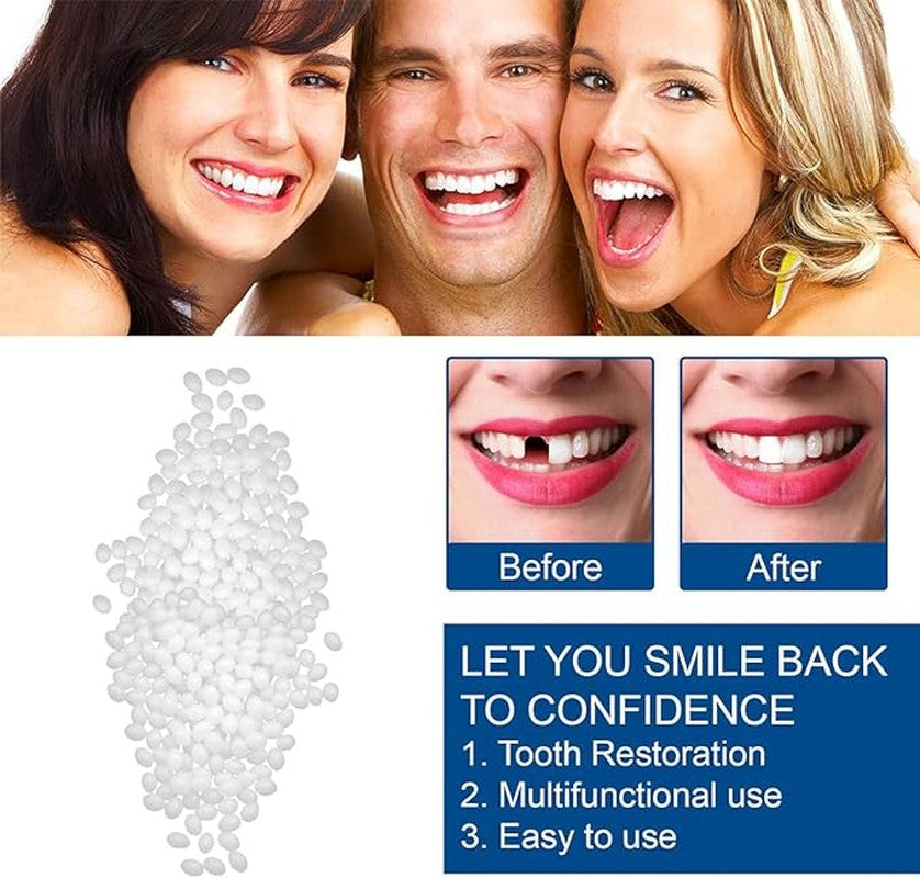 Temporary Tooth Repair Kit, Moldable Thermal Beads for DIY Teeth Replacement